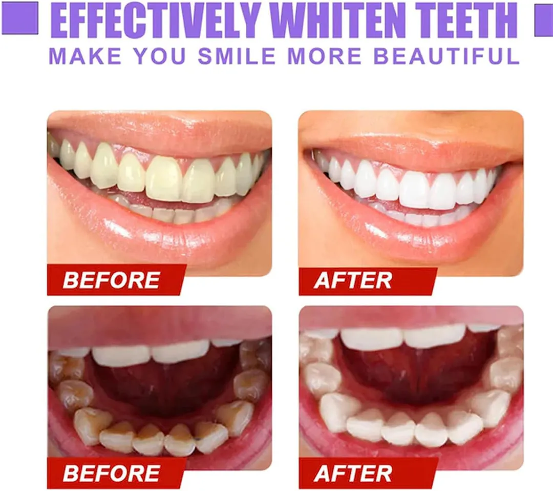 HISMILES Crema Dental Dientes v34: ¡La Revolución del Blanqueamiento Dental! - HISMILES crema dental dientes v34