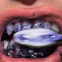 Blanqueamiento Suave y Seguro