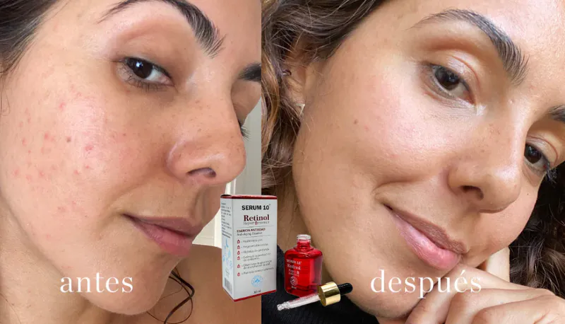 851095-SERUM 10 RETINOL REPARADOR - 851095-SERUM 10 RETINOL REPARADOR.