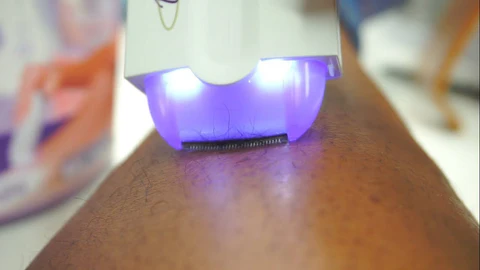 Tecnología Sensa-Light: Depilación Precisa y Sin Dolor