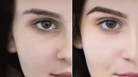 Dile Adiós al Vello Facial