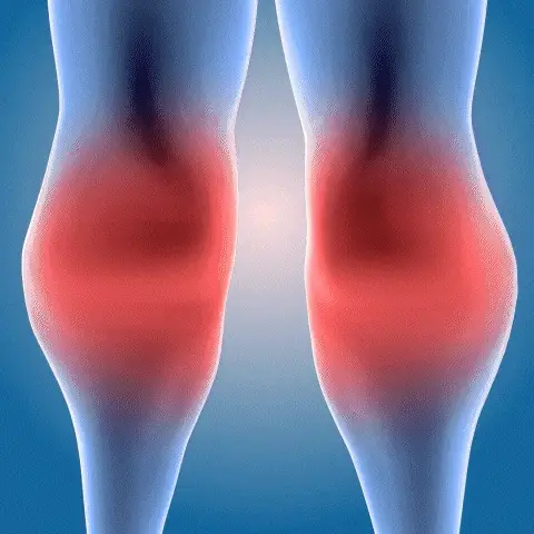 CREMA PERFECTX X 2 UNIDADES: Alivio Inmediato para Dolores Musculares y Articulaciones