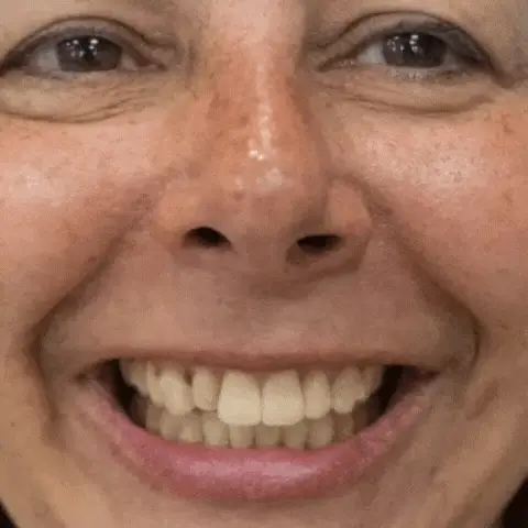 Tira Blanqueadora Dental BlancoRadiante®: ¡Sonríe con Confianza!