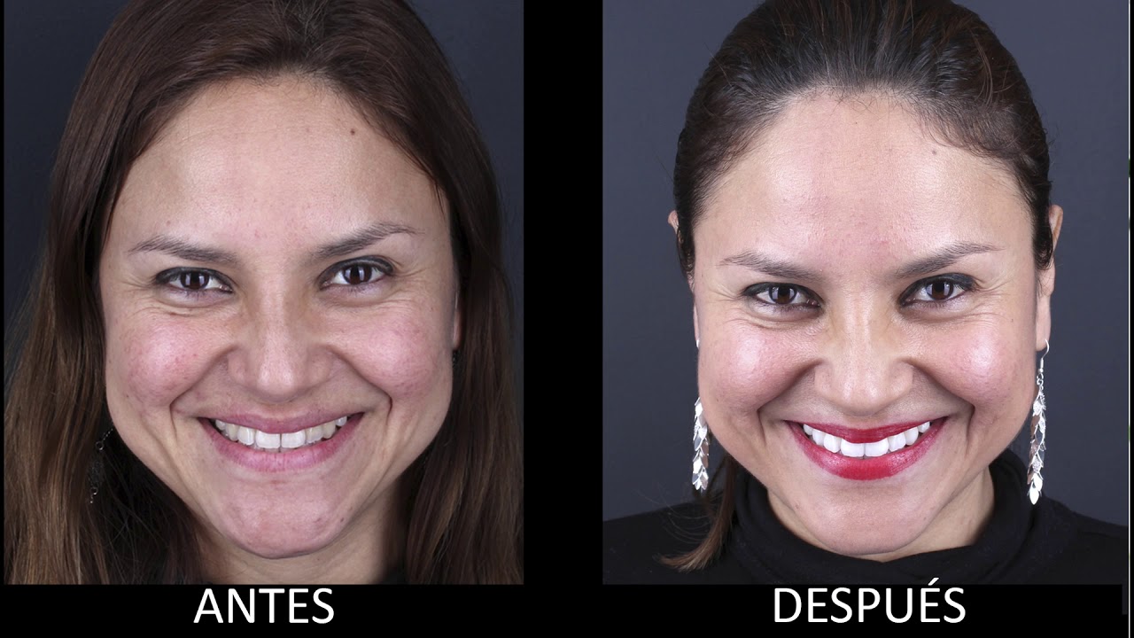 Recomendado por Expertos