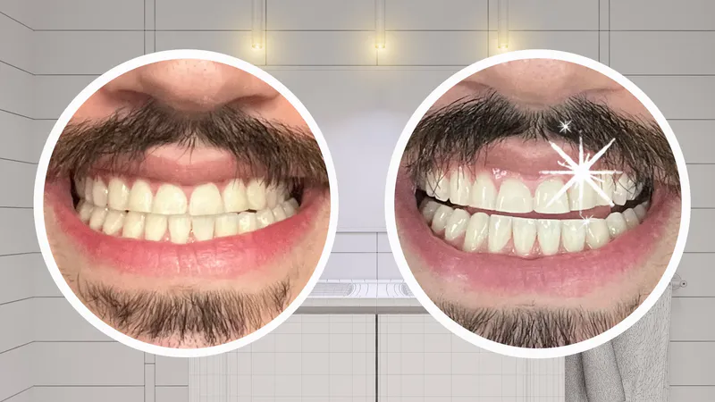 Transforma Tu Sonrisa Hoy