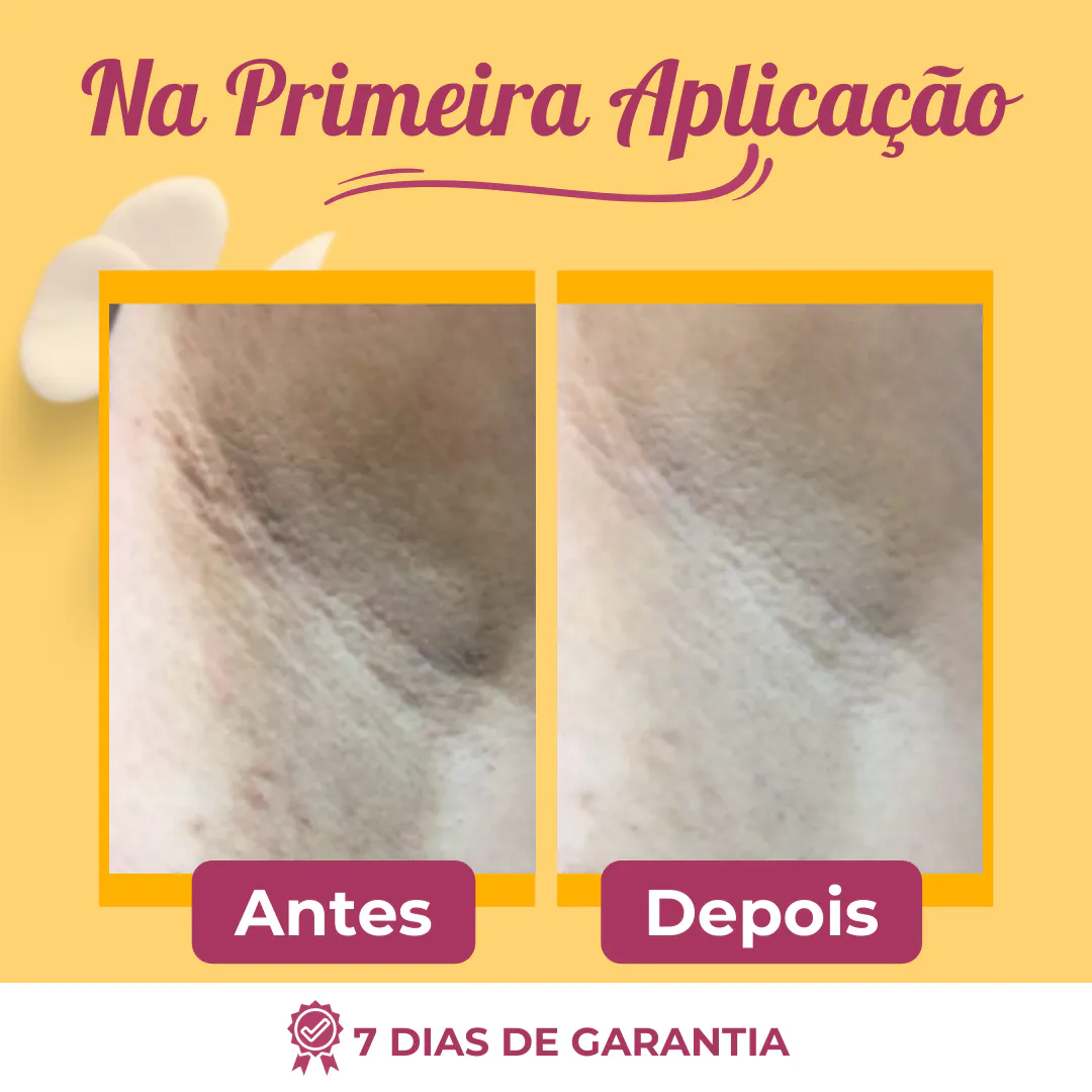 Retinou™: Crema Blanqueadora Antiarrugas para una Piel Radiante - 770013-CREMA BLANQUEADORA ANTIARRUGAS CO