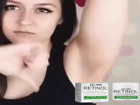 Retinou™: Crema Blanqueadora Antiarrugas para una Piel Radiante