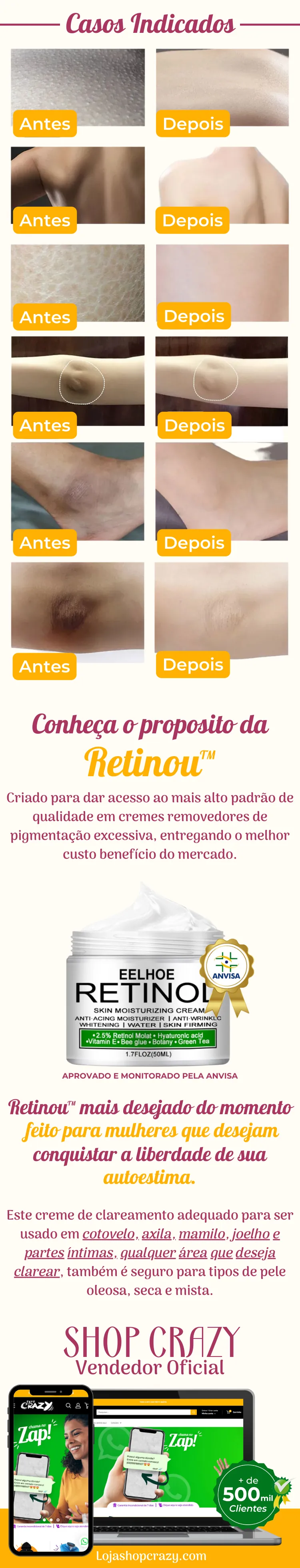 Transforma tu Piel con Retinou™