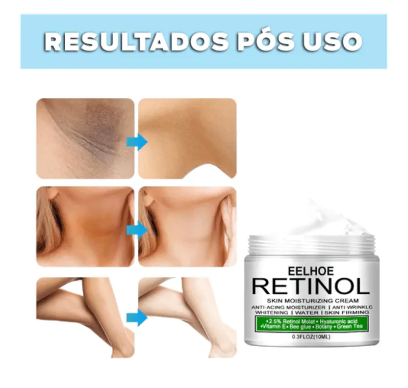 Experimenta la Diferencia con Retinou™