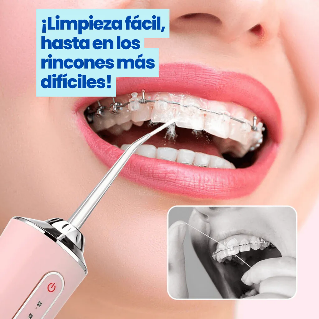 Irrigador Dental: Limpieza Profesional a tu Alcance - irrigador dental variante