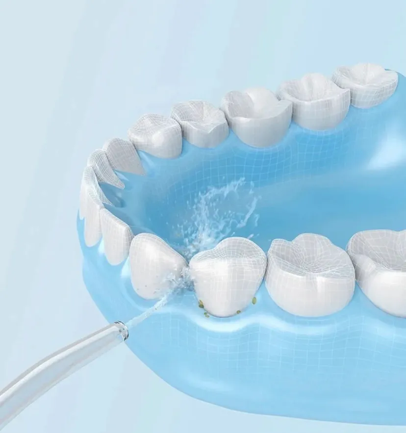 Irrigador Dental: Limpieza Profesional a tu Alcance - irrigador dental variante