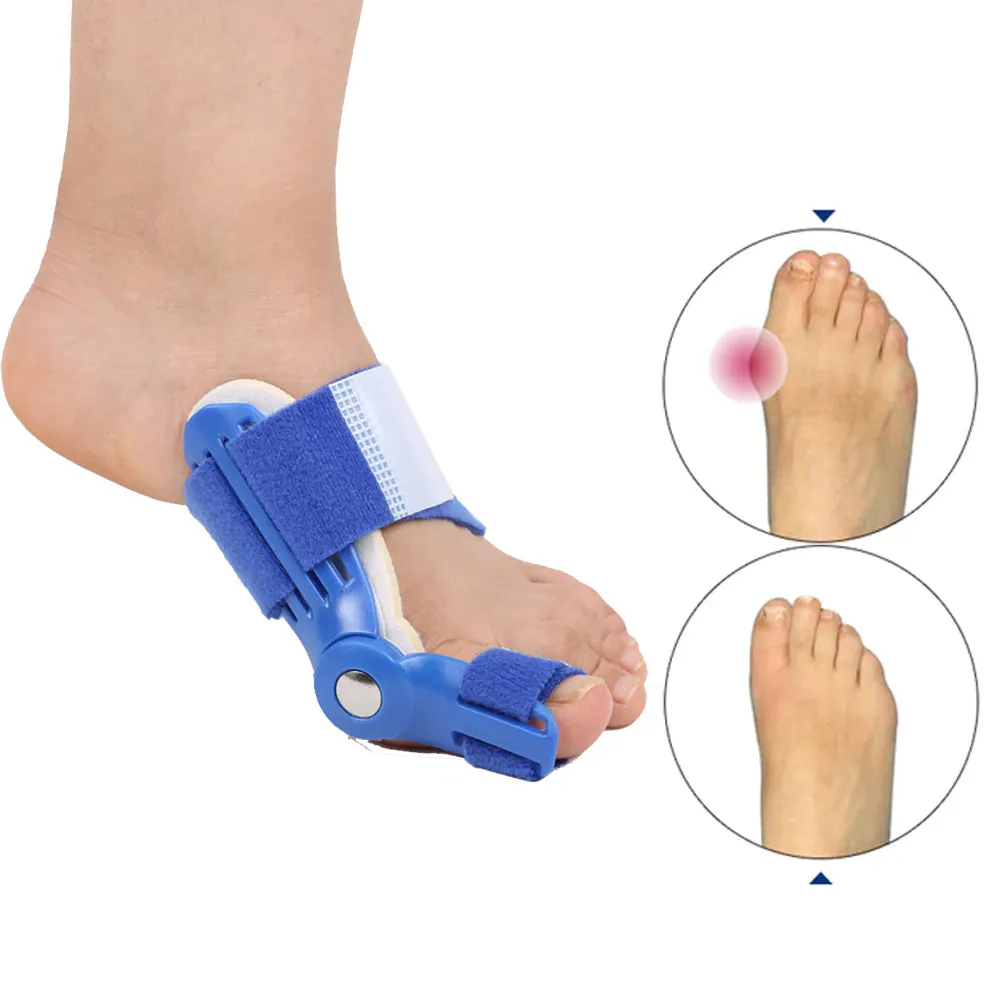 JUANETE PLASTICO 2 UND: Alivio y Corrección para Tus Pies - Corrector de juanetes X2 uds ajustables