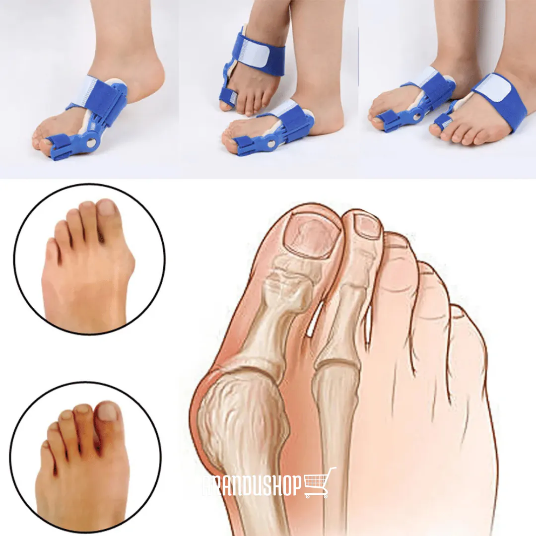 JUANETE PLASTICO 2 UND: Alivio y Corrección para Tus Pies - Corrector de juanetes X2 uds ajustables