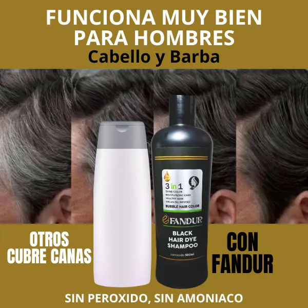 Kit Completo
