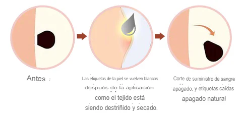 Resultados Naturales