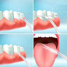 Irrigador Oral Recargable 3 Mod: La Limpieza Dental Profunda Que Necesitas - Irrigador Oral Recargable 3 Mod