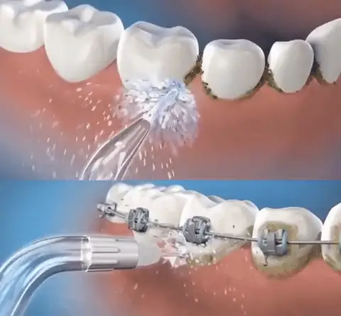 Irrigador Oral Recargable 3 Mod: La Limpieza Dental Profunda Que Necesitas