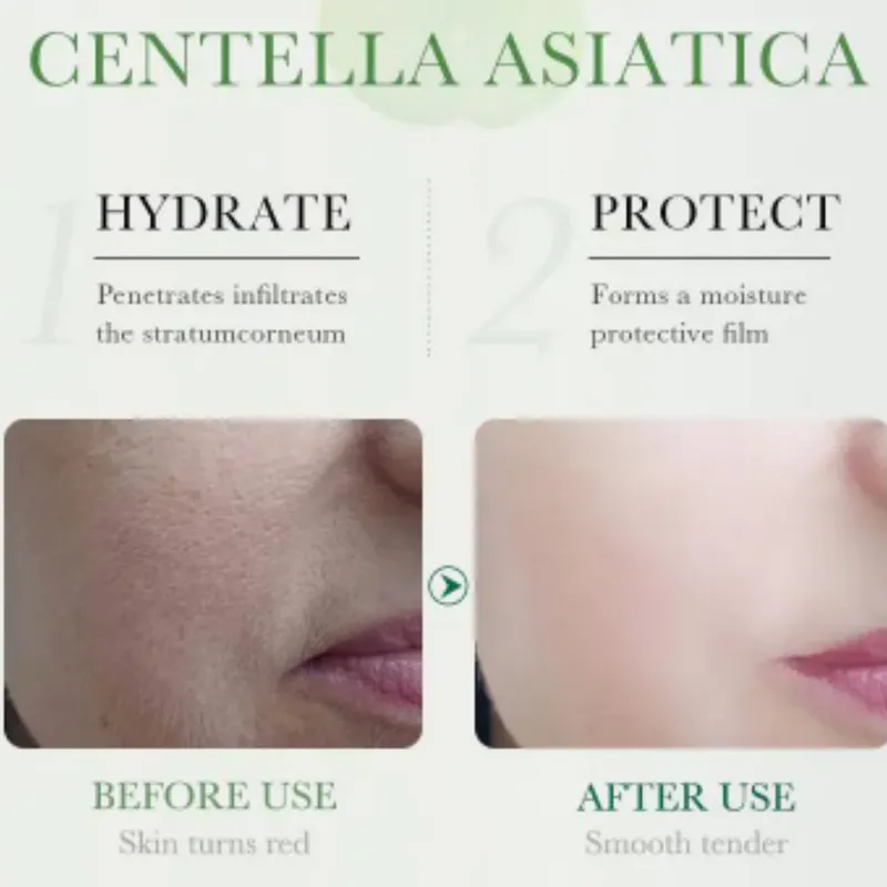El Poder de la Centella Asiática