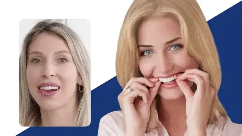 CARILLAS DENTAL: Sonríe con Confianza