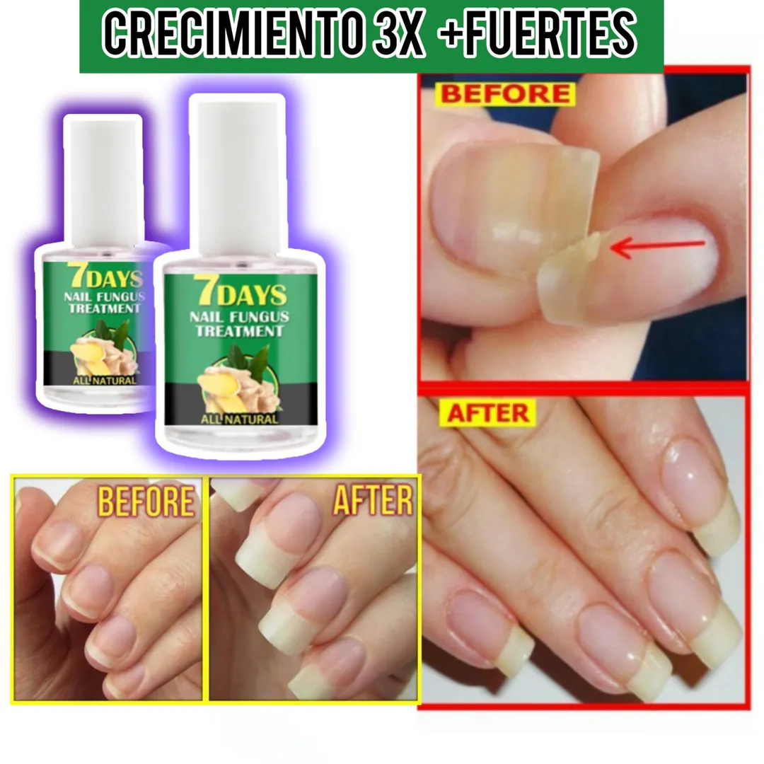 7 DAYS NAILS: El Secreto de Uñas Fuertes y Saludables - 7 DAYS NAILS endurecedor de uñas (2)