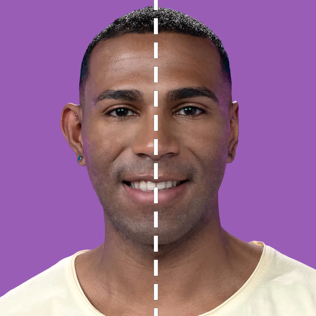 CORRECTOR DE OREJAS EARSTICK: La Solución Discreta y Efectiva - CORRECTOR DE OREJAS