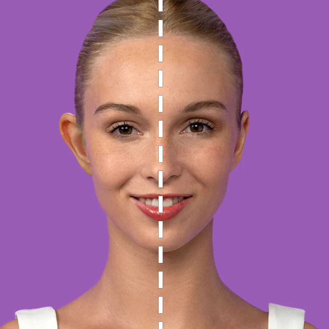 CORRECTOR DE OREJAS EARSTICK: La Solución Discreta y Efectiva - CORRECTOR DE OREJAS