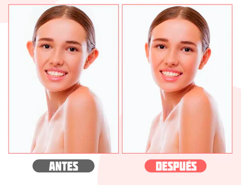Beneficios Incomparables