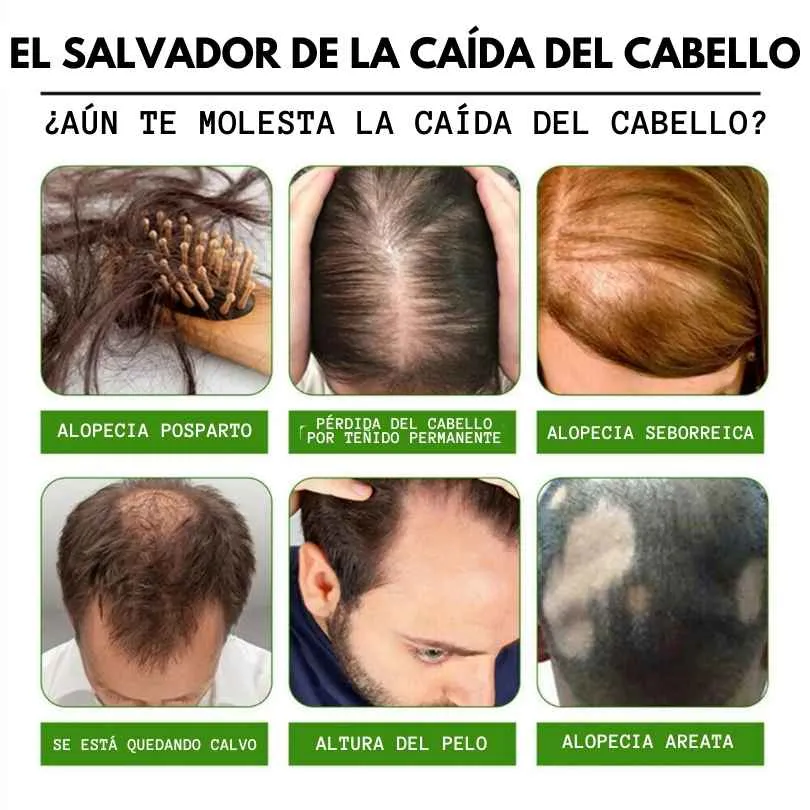 7 Días Crecimiento Capilar ORIGINAL - 7 Days crecimiento capilar ORIGINAL