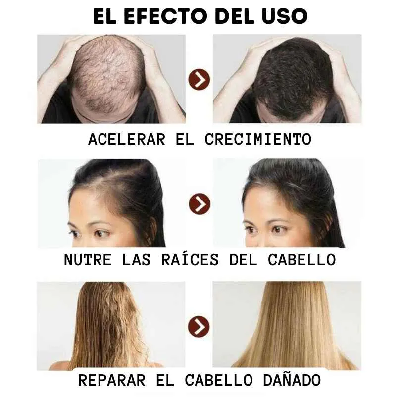 7 Días Crecimiento Capilar ORIGINAL - 7 Days crecimiento capilar ORIGINAL