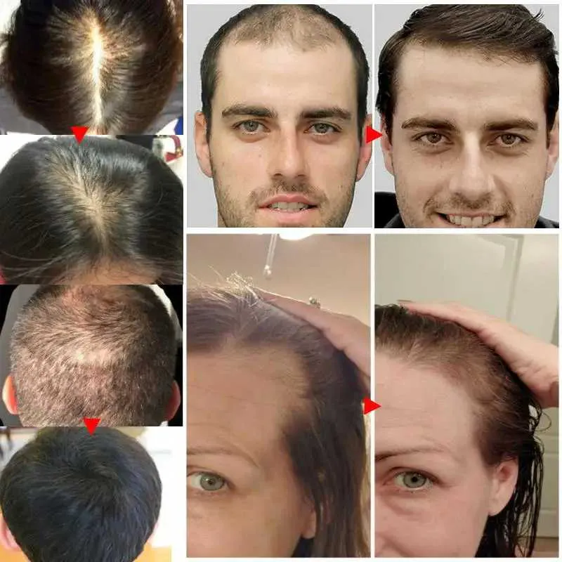 7 Días Crecimiento Capilar ORIGINAL - 7 Days crecimiento capilar ORIGINAL