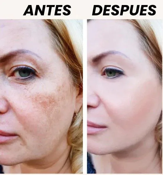 Crema Aclarante Zamia: ¡Despierta la Belleza Natural de tu Piel! - 1 Crema ANTIESTRÍAS +Crema Aclarante (2)