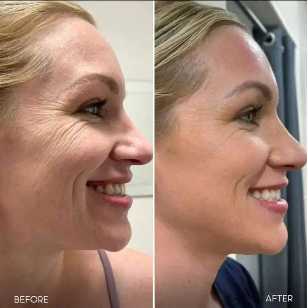Masajeador Facial Reductor De Papada: ¡Dile Adiós a la Papada y Rejuvenece tu Piel! - Masajeador Facial quita Papada
