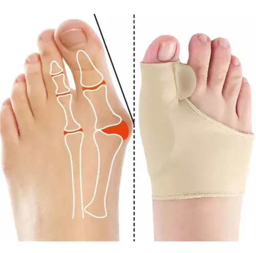 Corrector de Juanetes x2: Alivio y Comodidad para tus Pies - Corrector de juanetes x2