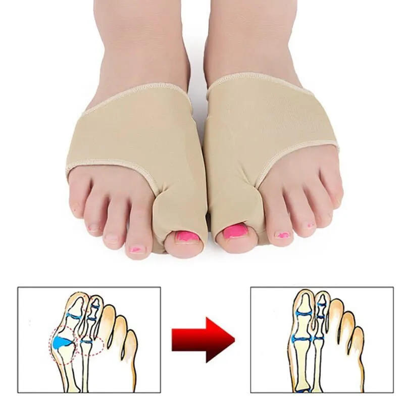 Corrector de Juanetes x2: Alivio y Comodidad para tus Pies - Corrector de juanetes x2