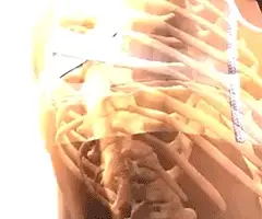 Adiós al Dolor de Espalda