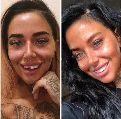 Confianza en Cada Sonrisa