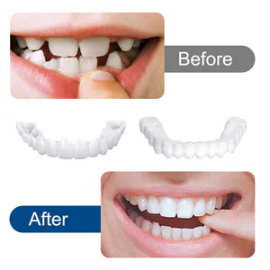 Montura Carillas Dentales Postizas: La Sonrisa Perfecta al Alcance de Tu Mano - Montura Carillas dentales postizas