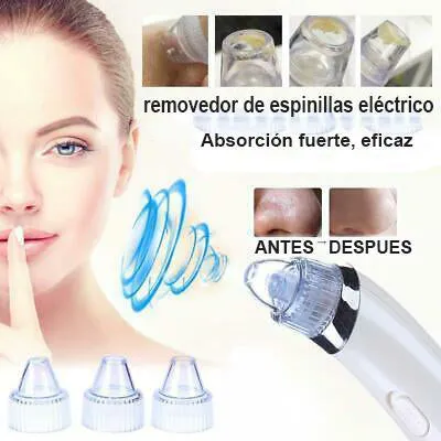 EXTRACTOR DE ESPINILLAS Y PUNTOS NEGROS: ¡Adiós Imperfecciones! - EXTRACTOR DE ESPINILLAS PUNTOS NEGROS