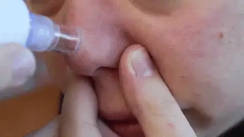 Tecnología de Punta para una Piel Perfecta