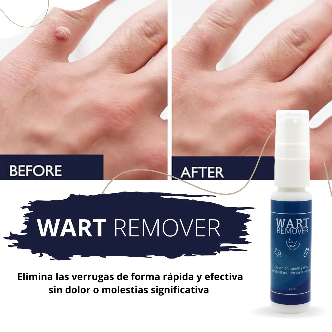 WART REMOVER AZUL X2: ¡Dile Adiós a las Verrugas para Siempre! - WART REMOVER AZUL X2
