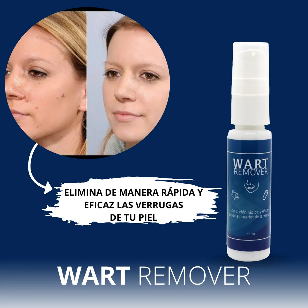 WART REMOVER AZUL X2: ¡Dile Adiós a las Verrugas para Siempre! - WART REMOVER AZUL X2