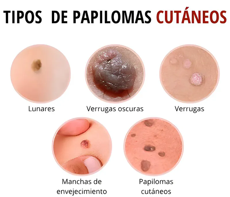 Resultados Visibles en Solo 5 Días