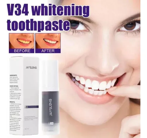 Blanqueador Dental Morada V34: ¡Sonríe con Confianza! - Blanqueador Dental Morada v34