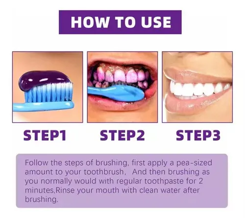 Blanqueador Dental Morada V34: ¡Sonríe con Confianza! - Blanqueador Dental Morada v34