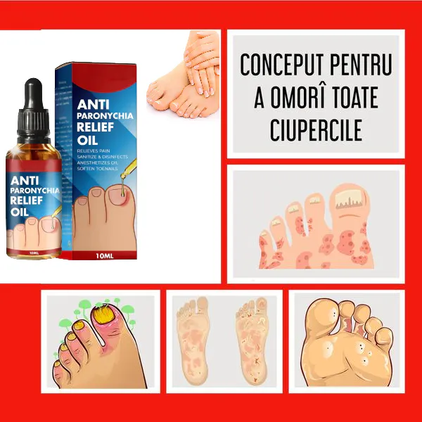 ANTI HONGO TOENAILPLUS: ¡Adiós a las uñas afectadas por hongos! - ANTI HONGO TOENAILPLUS