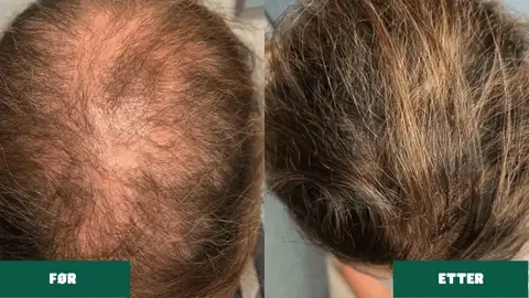 Descubre la Potencia del Jengibre para tu Cabello