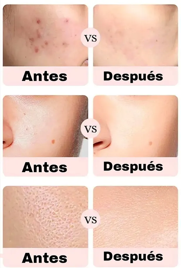 Vitamina C. Acido Hialuronico, Serum 24K