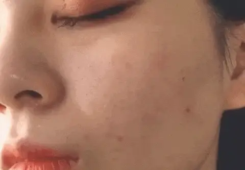 ¡Dile adiós a las imperfecciones!