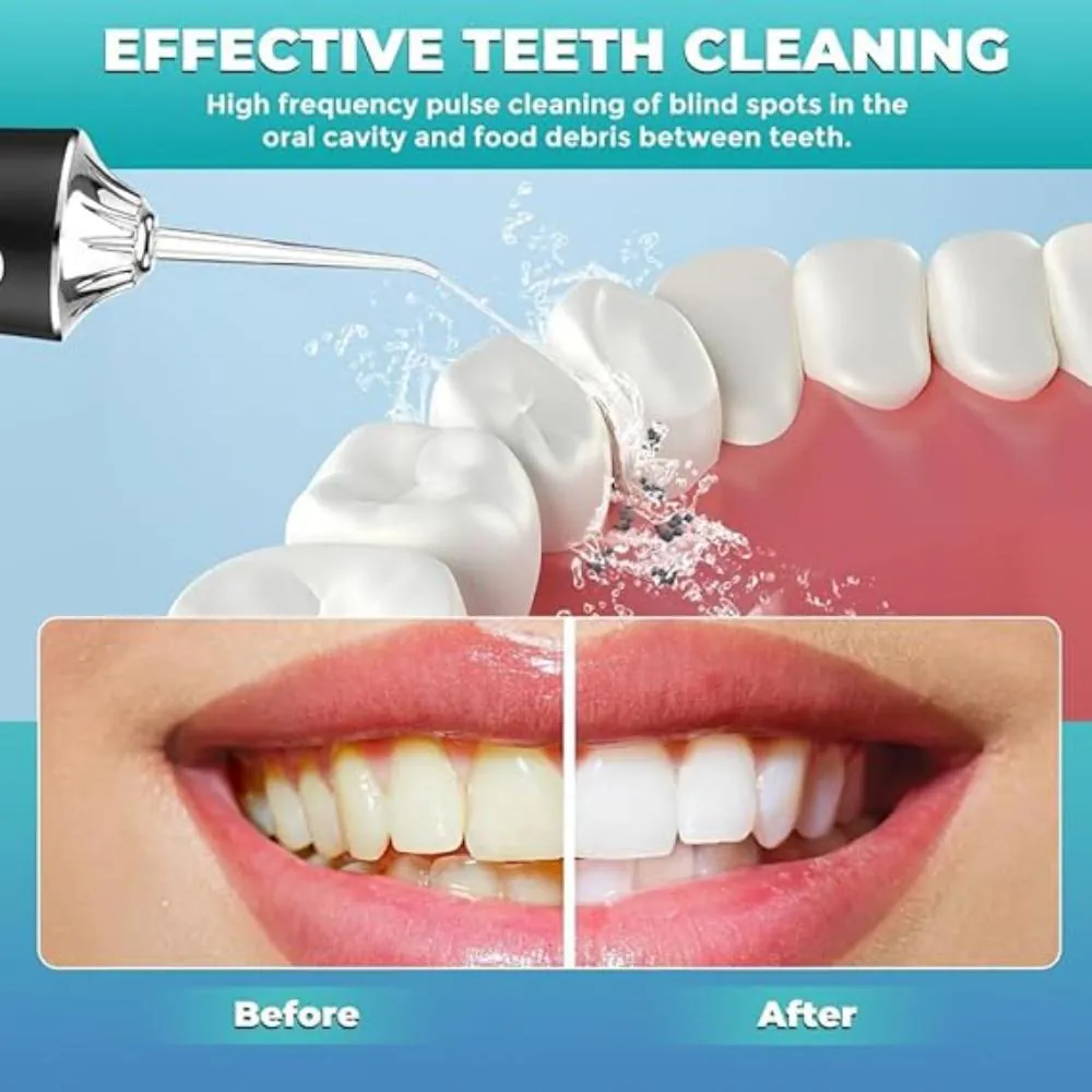 Irrigador Dental Emporio™: Limpieza Oral a un Nuevo Nivel - IRRIGADOR DENTAL