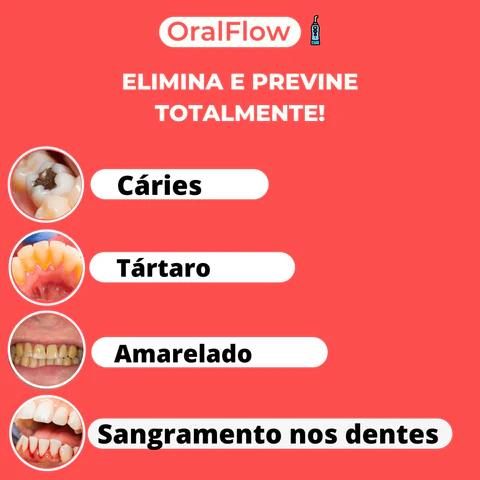 Irrigador Dental Emporio™: Limpieza Oral a un Nuevo Nivel